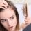باورهای غلط درباره ریزش مو